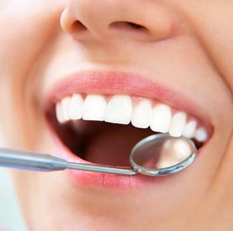 Tips to Prevent Tooth Decay for a Healthy Smile That Lasts!