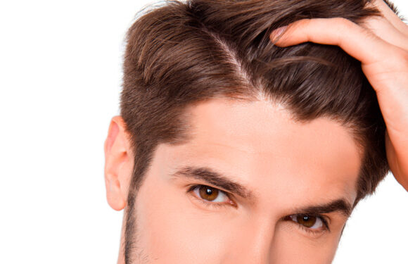 How Can Hair Loss Be Treated for Guys?