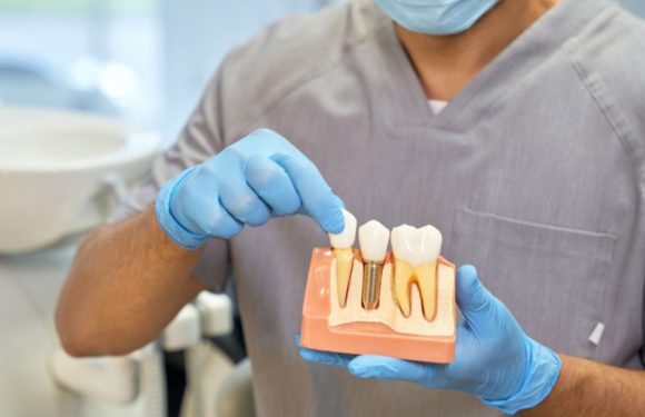 Top 5 Compelling Reasons to Get Dental Implants
