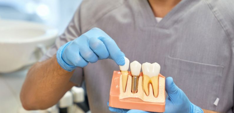 Top 5 Compelling Reasons to Get Dental Implants