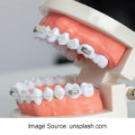 How to Choose a Good Orthodontist