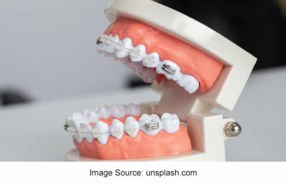 How to Choose a Good Orthodontist?