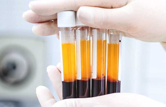 The Science Behind StemCellCure’s Platelet-Rich Plasma (PRP) + Stem Cell Combo Therapy