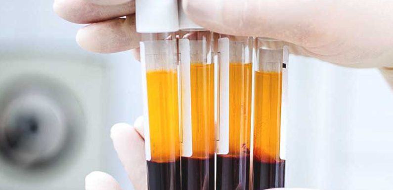 The Science Behind StemCellCure’s Platelet-Rich Plasma (PRP) + Stem Cell Combo Therapy