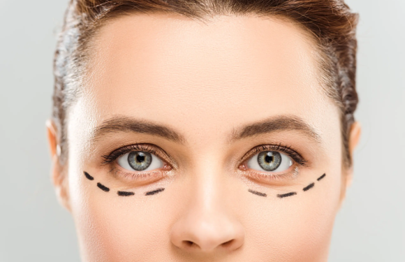 Blepharoplasty in Barcelona: A More Rested and Natural Look
