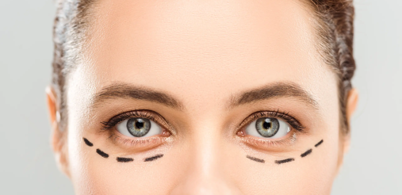 Blepharoplasty in Barcelona: A More Rested and Natural Look